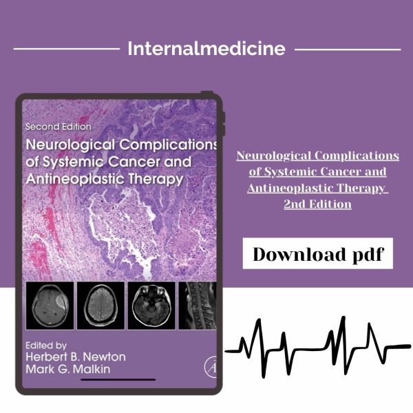Neurological Complications of Systemic Cancer and Antineoplastic Therapy 2nd Edition