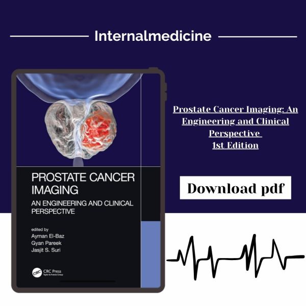 Prostate Cancer Imaging: An Engineering and Clinical Perspective 1st Edition