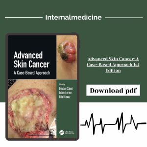 Advanced Skin Cancer: A Case-Based Approach 1st Edition