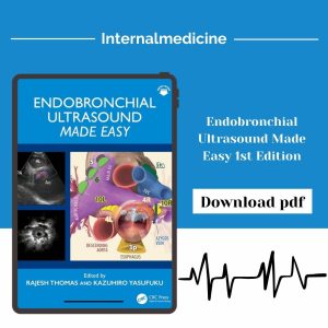 Endobronchial Ultrasound Made Easy 1st Edition