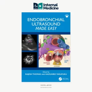 Endobronchial Ultrasound Made Easy 1st Edition