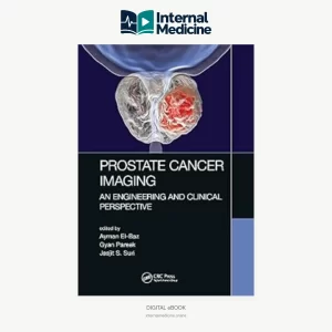 Prostate Cancer Imaging An Engineering and Clinical Perspective 1st Edition