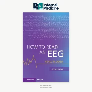 How to Read an EEG 2nd Edition