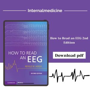 How to Read an EEG 2nd Edition