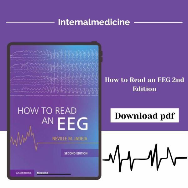 How to Read an EEG 2nd Edition