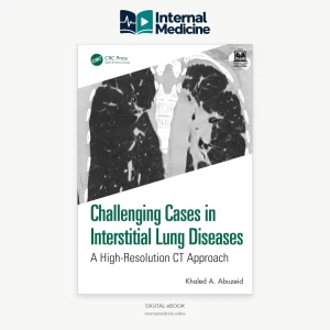 Challenging Cases in Interstitial Lung Diseases 1st Edition