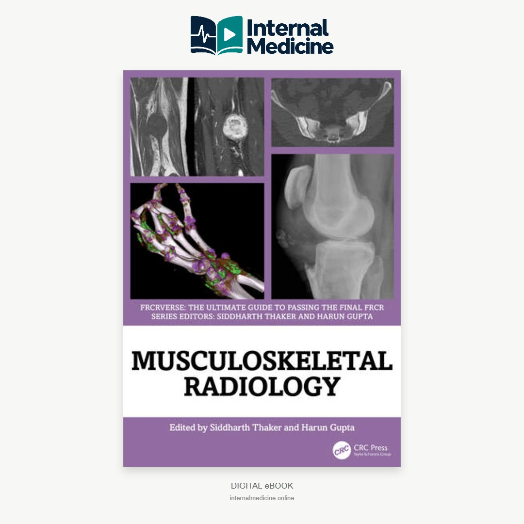 Musculoskeletal Radiology An Ultimate Guide to Passing the Final FRCR (FRCRverse) 1st Edition