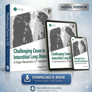 Challenging Cases in Interstitial Lung Diseases 1st Edition