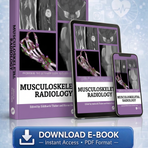 Musculoskeletal Radiology An Ultimate Guide to Passing the Final FRCR (FRCRverse) 1st Edition