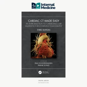 Cardiac CT Made Easy, Third Edition, Paul Schoenhagen and Frank Dong