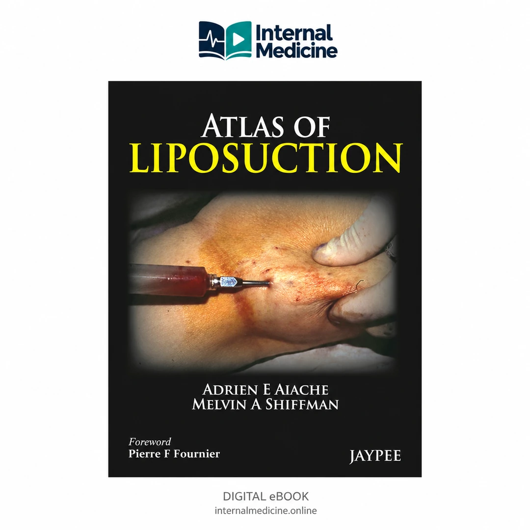 Atlas of Liposuction — 1st Edition