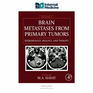Brain Metastases from Primary Tumors: Epidemiology, Biology, and Therapy — Volume 1