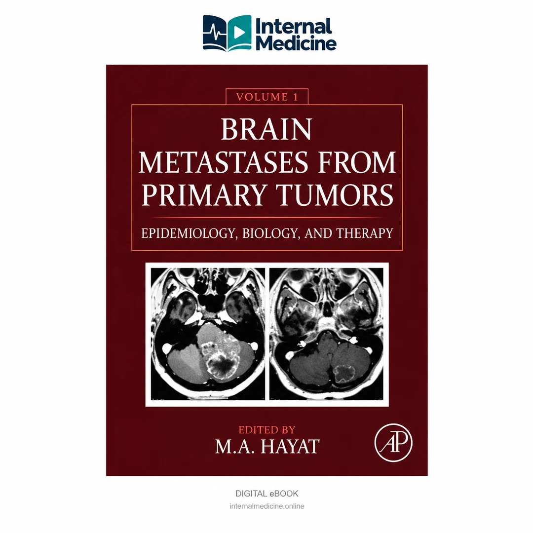 Brain Metastases from Primary Tumors: Epidemiology, Biology, and Therapy — Volume 1