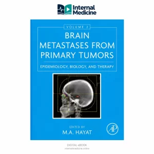 Brain Metastases from Primary Tumors: Epidemiology, Biology, and Therapy — Volume 2