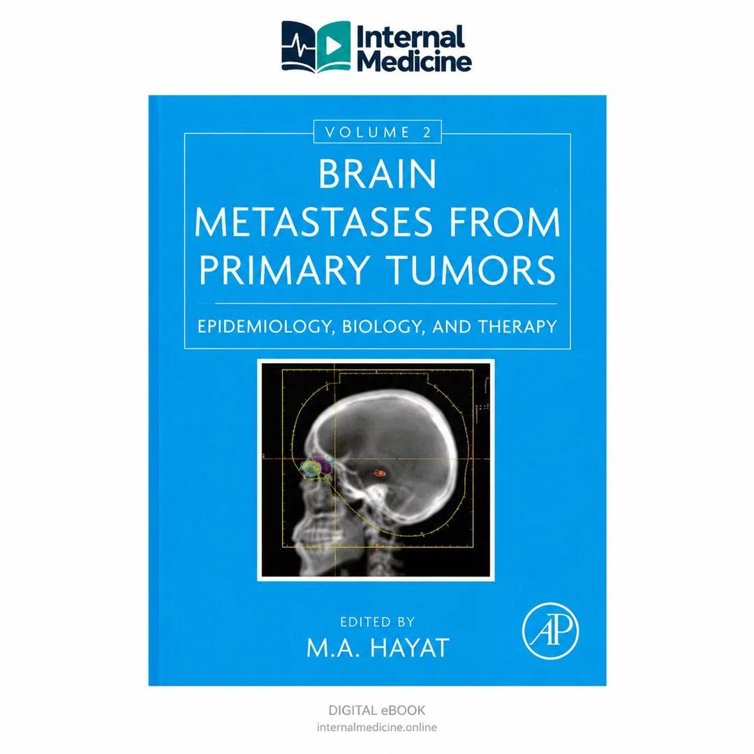 Brain Metastases from Primary Tumors: Epidemiology, Biology, and Therapy — Volume 2
