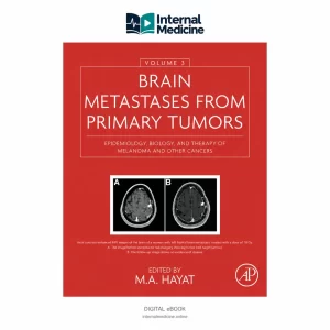 Brain Metastases from Primary Tumors: Epidemiology, Biology, and Therapy of Melanoma and Other Cancers — Volume 3