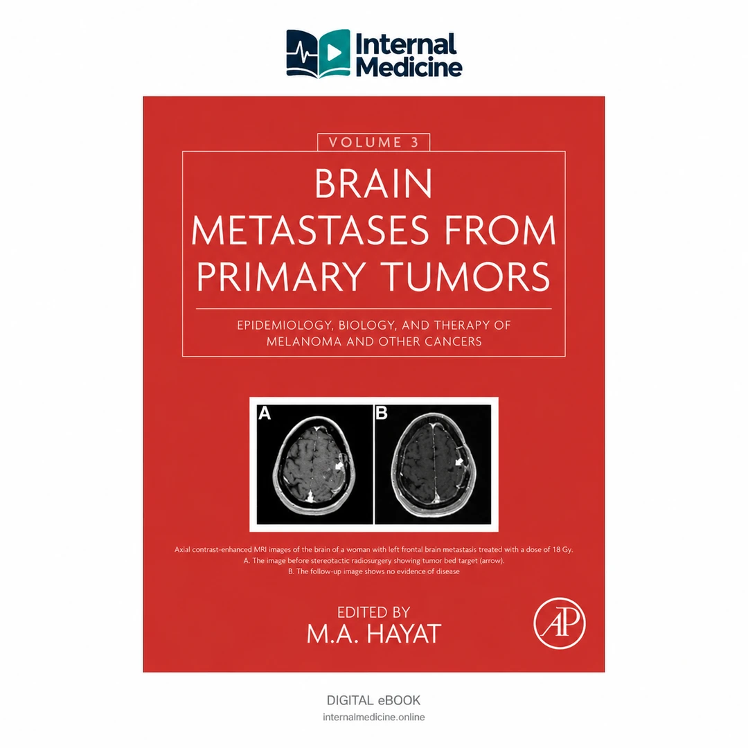 Brain Metastases from Primary Tumors: Epidemiology, Biology, and Therapy of Melanoma and Other Cancers — Volume 3