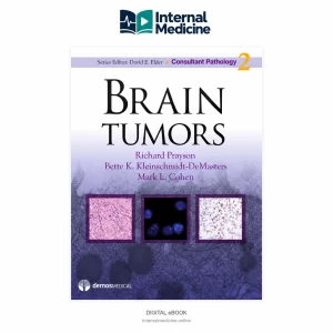 Brain Tumors — Consultant Pathology Series