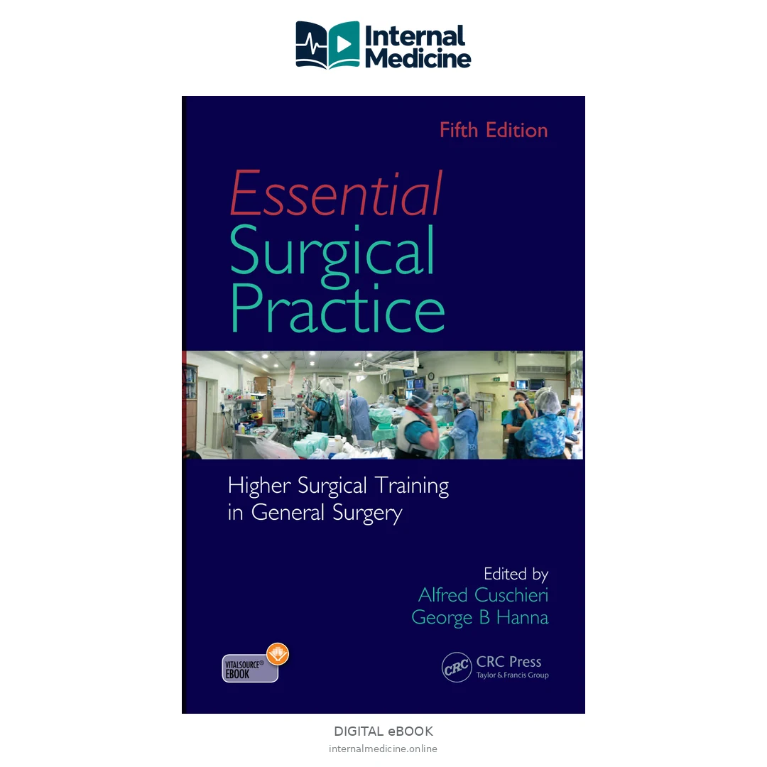 Essential surgical practice, Cuschieri — PDF — Digital eBook