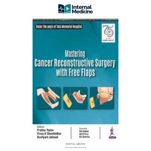 Mastering Cancer Reconstructive Surgery with Free Flaps — PDF — Digital eBook