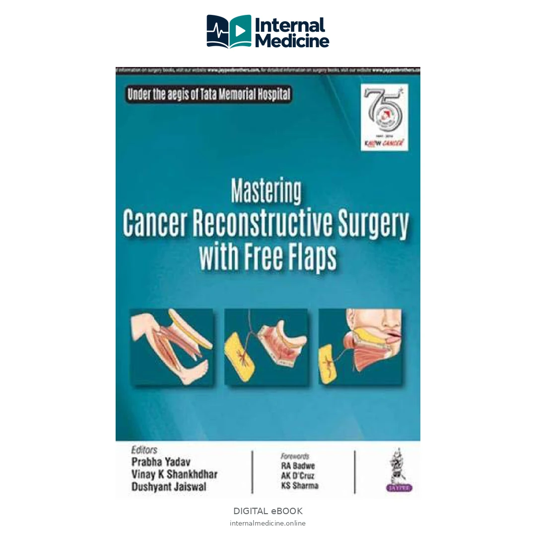 Mastering Cancer Reconstructive Surgery with Free Flaps — PDF — Digital eBook