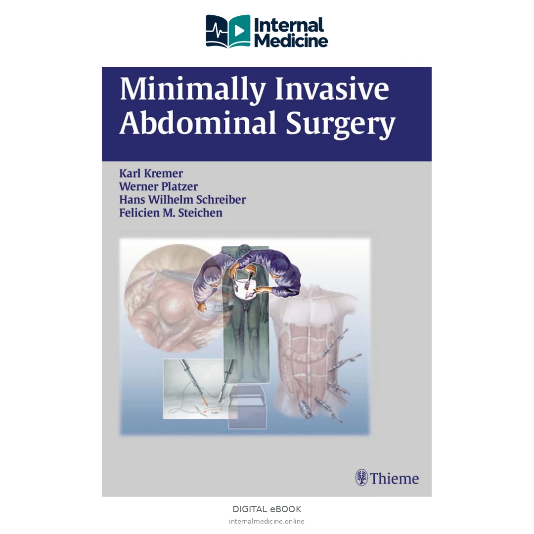 Minimally Invasive Abdominal Surgery — PDF — Digital eBook
