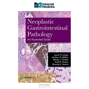 Neoplastic Gastrointestinal Pathology — Digital eBook