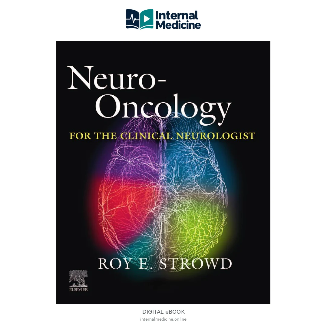 Neuro-Oncology for the Clinical Neurologist — Digital eBook
