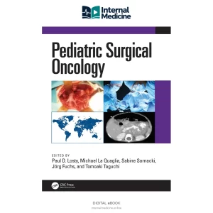 Pediatric Surgical Oncology — PDF — Digital eBook