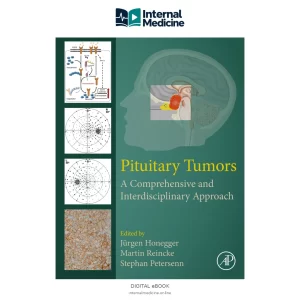 PITUITARY TUMORS — PDF — Digital eBook