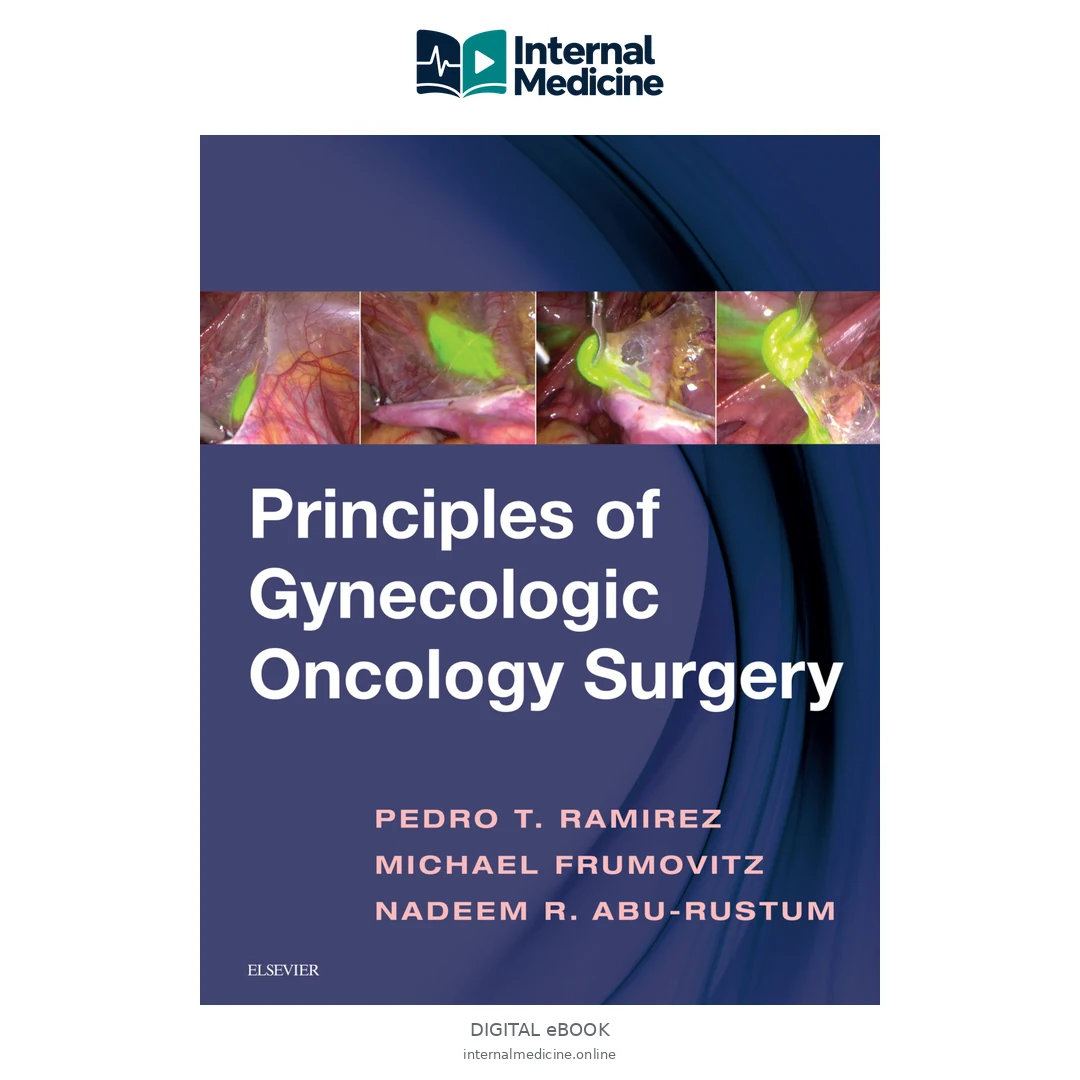 Principles of Gynecologic Oncology Surgery — PDF — Digital eBook