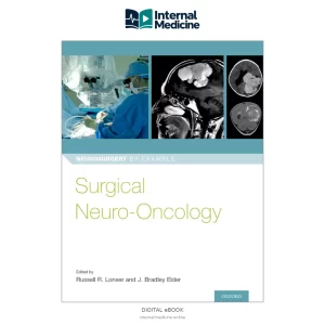 Surgical Neuro-Oncology — PDF — Digital eBook