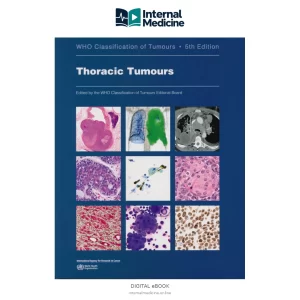 Thoracic Tumours — PDF — Digital eBook