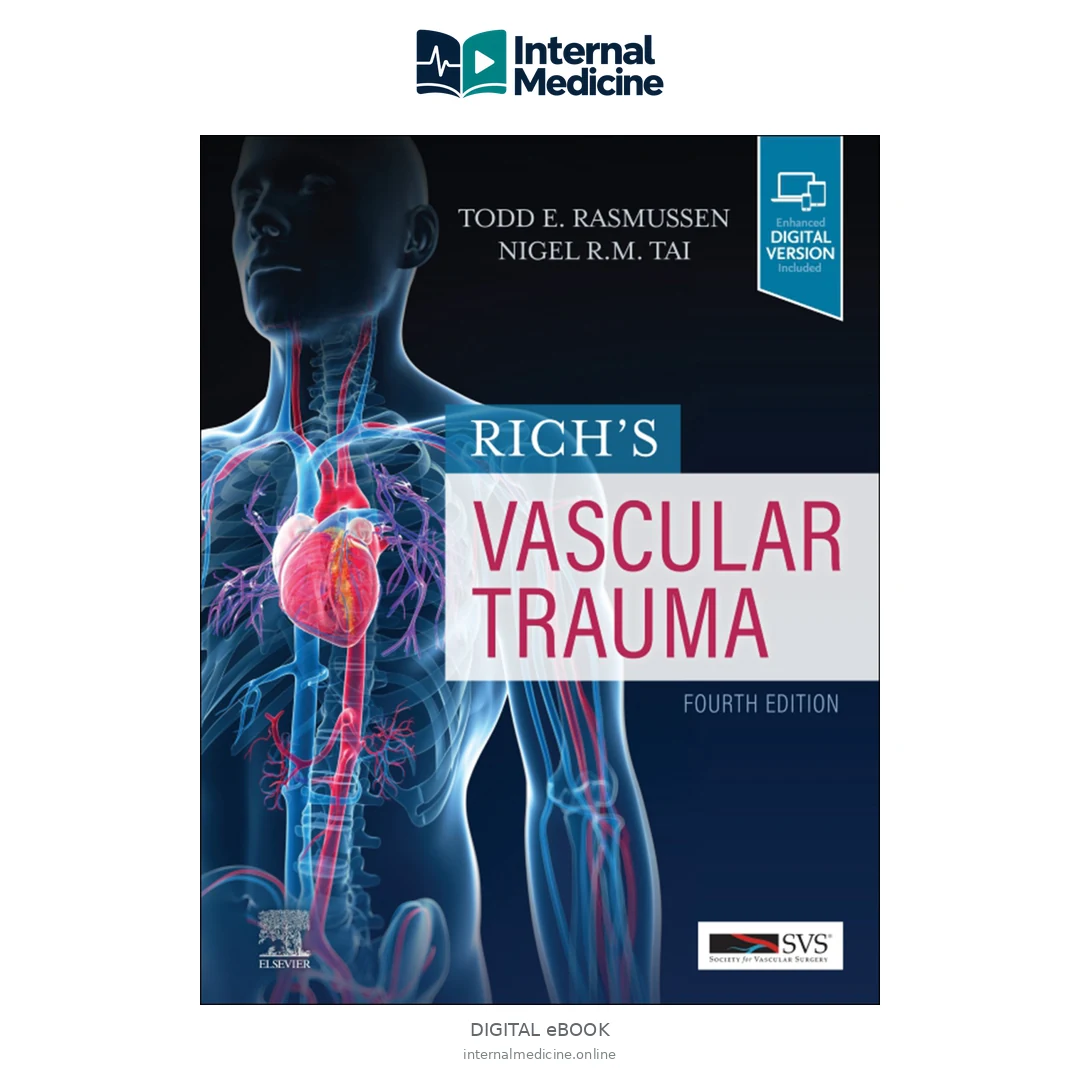 Todd E Rasmussen, Nigel R M Tai Rich’s Vascular Trauma Elsevier — PDF — Digital eBook