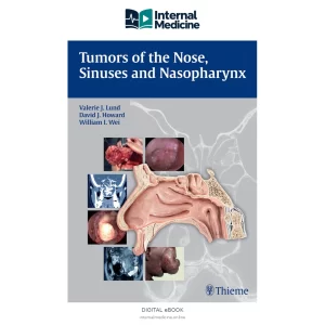 Tumors of the Nose,Sinuses,and Nasopharynx — PDF — Digital eBook