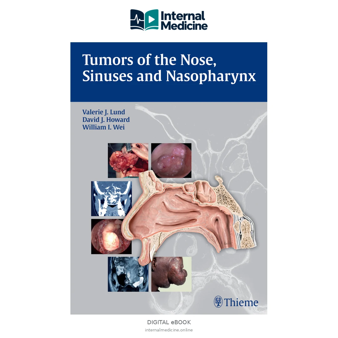 Tumors of the Nose,Sinuses,and Nasopharynx — PDF — Digital eBook