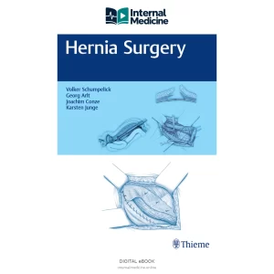 Volker Schumpelick, Georg Arlt, Joachim Conze, Karsten Junge Hernia — PDF — Digital eBook