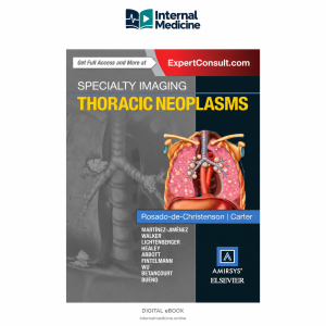 Specialty Imaging: Thoracic Neoplasms — 2016 Edition — PDF eBook