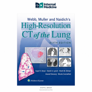 Webb, Müller and Naidich’s High-Resolution CT of the Lung — 6th Edition — PDF eBook